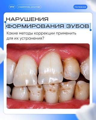 Гипоплазия эмали. Как отличить дефект развития от травмы?